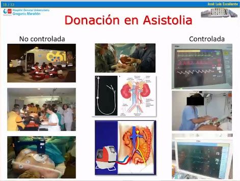 Donacion en asistolia